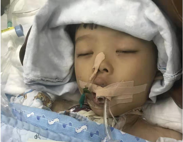 5岁男童幼儿园饭后体内检出老鼠药成分，治疗15天后离世，幼儿园负责人被刑拘