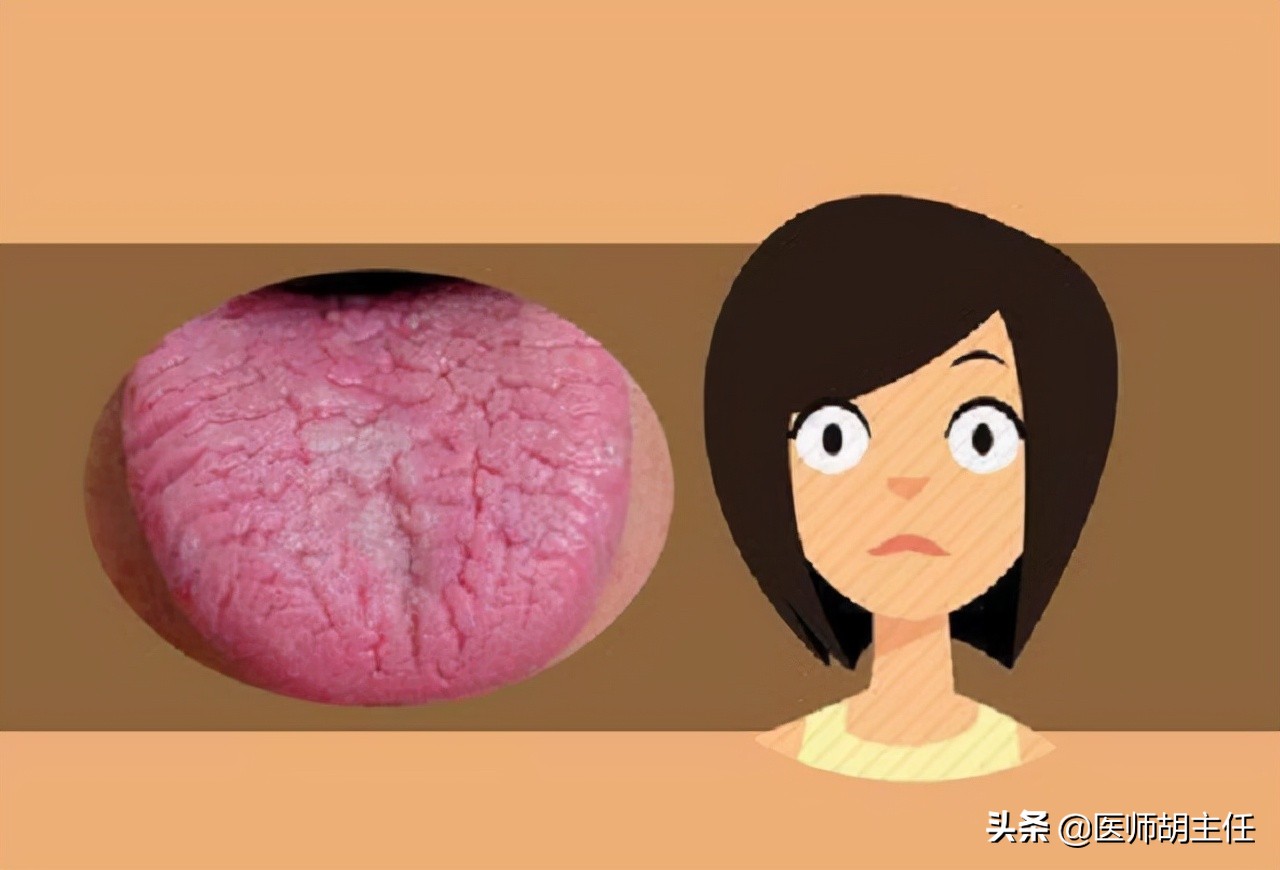 甲钴胺不仅能修复受损神经，还能用于这几种常见病的治疗，好用