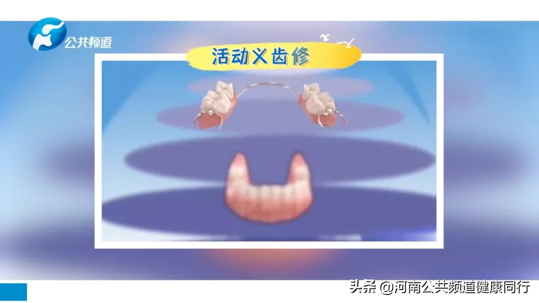 关注口腔 爱在植得 | 高昂:牙齿缺失影响全身健康,特别是老年人,不可忽视