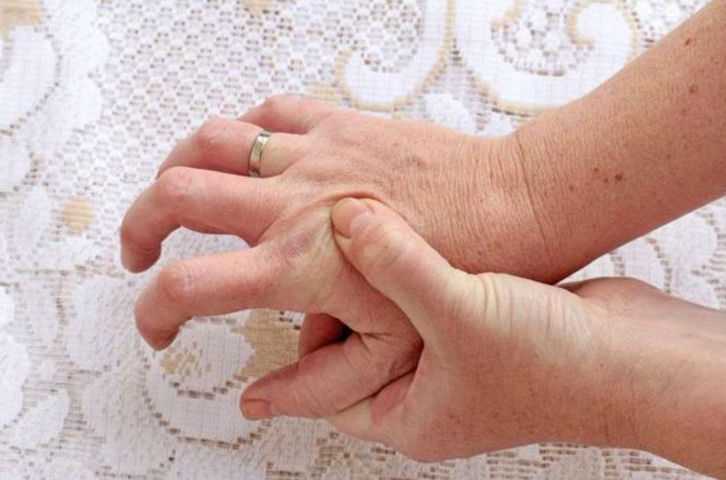 手痛麻木疼痛怎么办(总觉得手发麻)