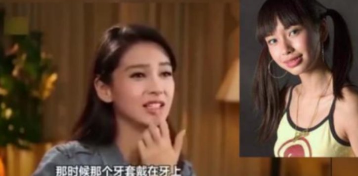 整容必脸崩？这10位女星告诉你，只要“美商”高，颜值事业可双赢