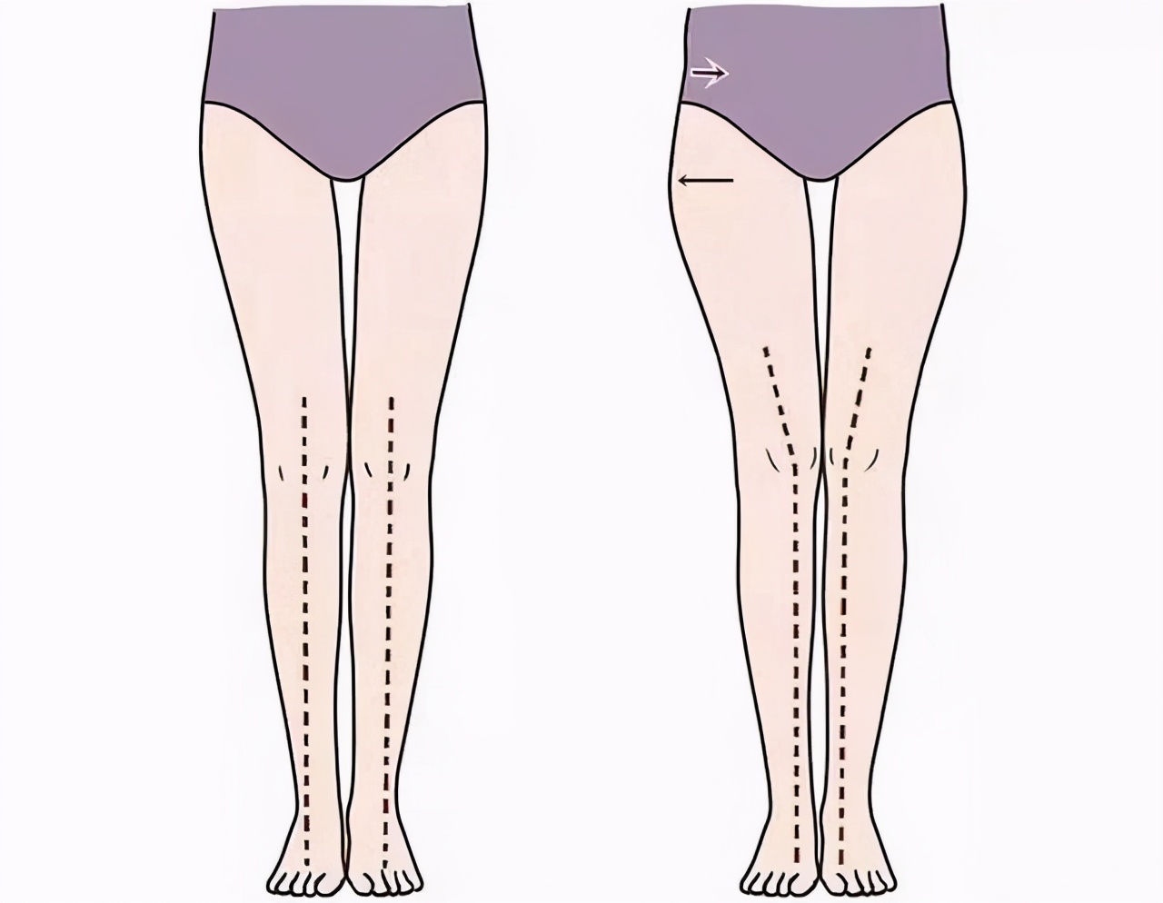 怎样才能让腿变长(让你的腿变长显瘦第一步，不是减脂，而是消除假胯，3个动作搞定)