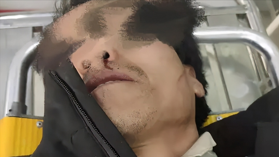 讨要工资1家3口被殴打住院，警方协调赔偿10万私了，法理分析