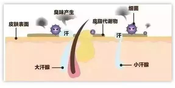 腋臭治疗过程大揭秘，有图有真相