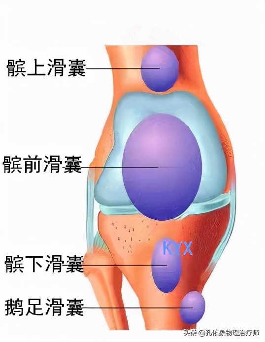 膝关节肿胀、积液、还伴疼痛，是啥原因引发的？该咋办？请看此文