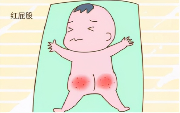 当宝宝无端哭闹,原来是遇上肛周脓肿,宝妈们应该怎么办