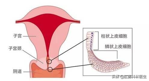 宫颈糜烂到底算疾病吗？为什么医生一定要我做手术