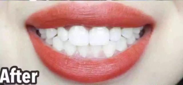 笑起来好看的女星都有一口假牙！牙齿要重视，多数人都用错了牙膏