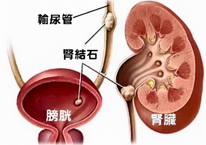 为什么会有“痛风不怕它痛，就怕它不痛了！”的说法？