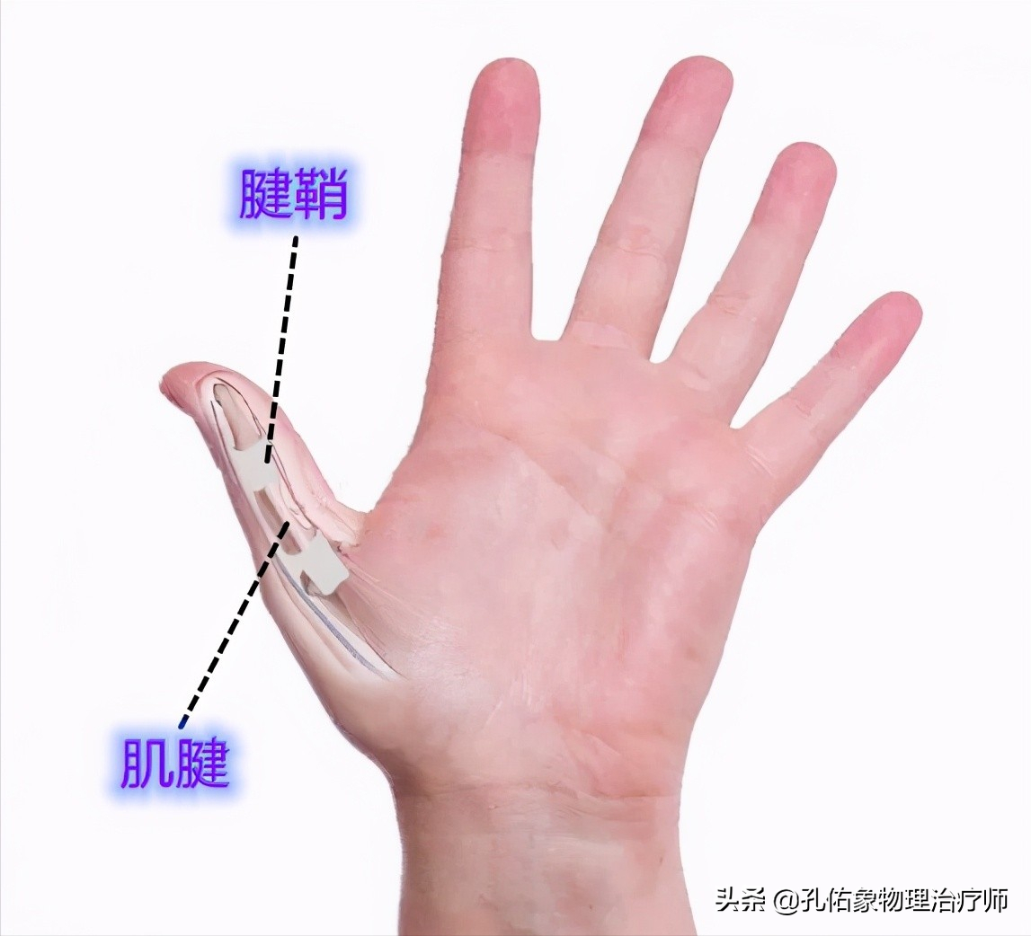 手指肿胀、僵硬、疼痛、有结节，挺挺就过去了？辟谣，趁早诊治