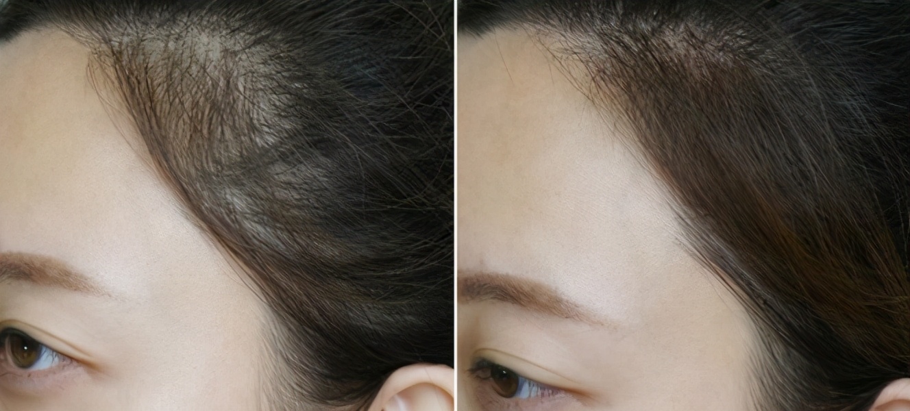 孟佳因发质细软承认戴假发片，发质不好怎么拯救头发造型？