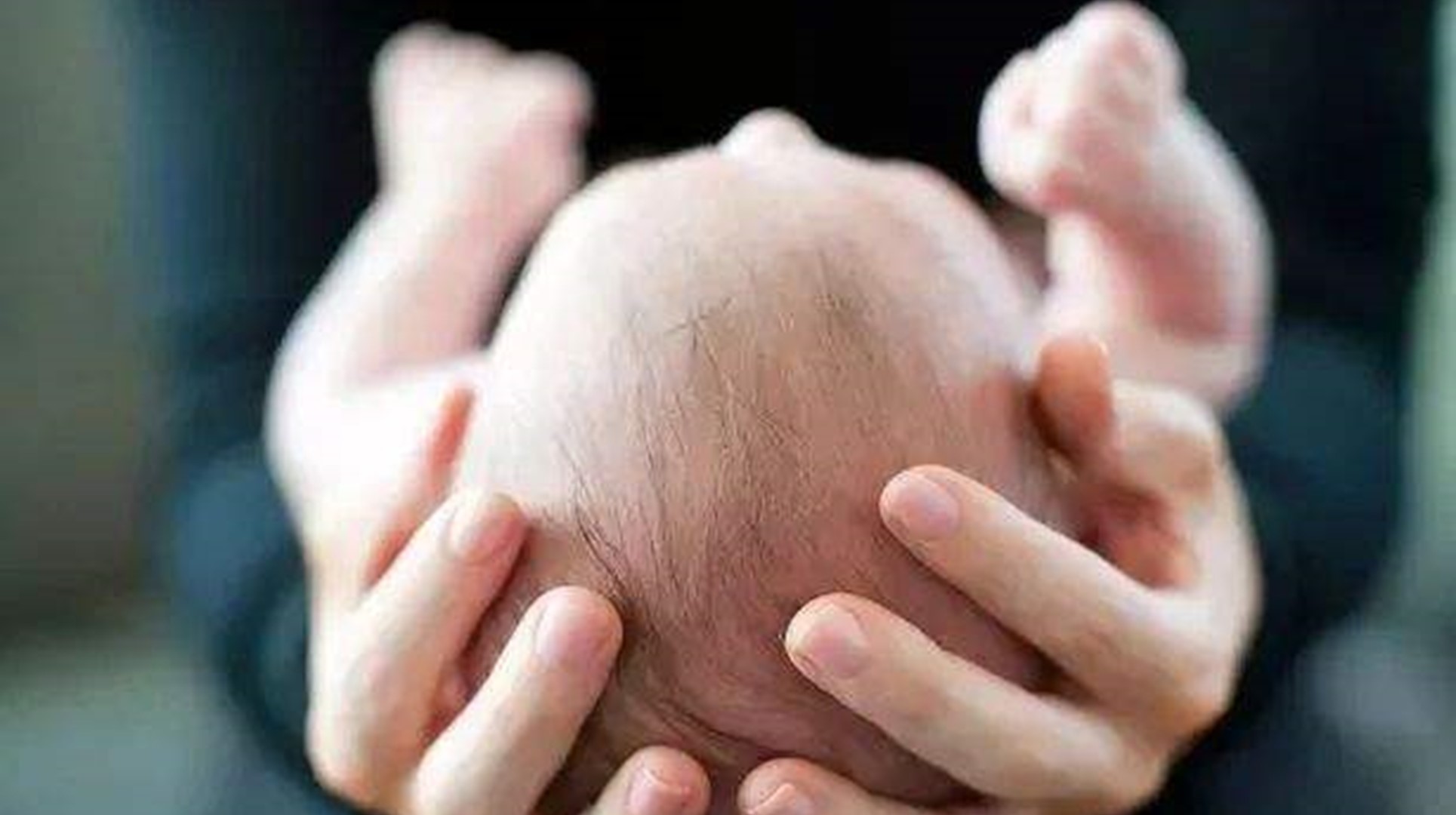 婴儿头垢图片（新生儿常见的六种特殊生理现象）-幼儿百科-魔术铺