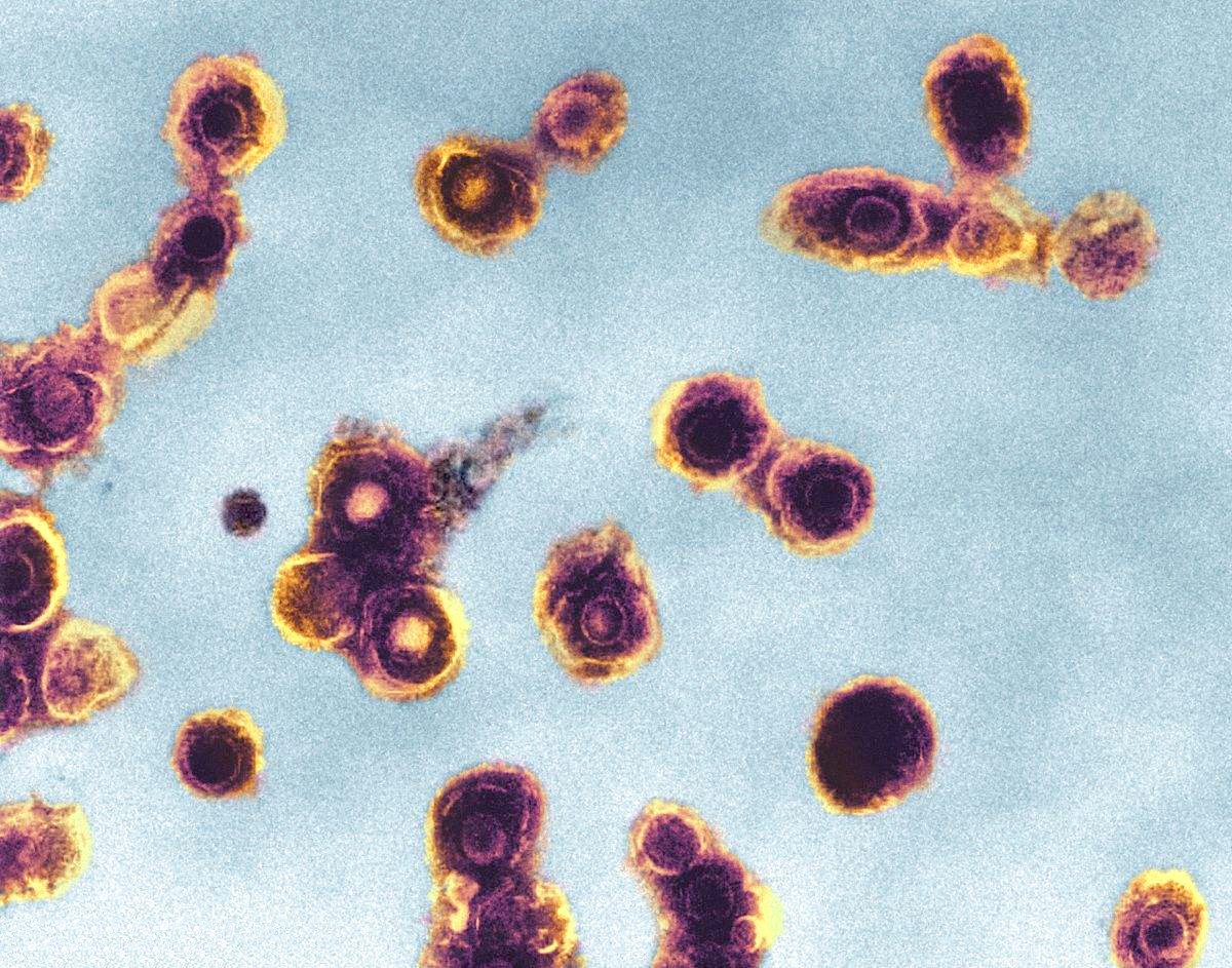 带状疱疹的临床症状有哪些？会传染吗？