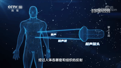 在家就能做B超？帮你节省医院排队的时间！