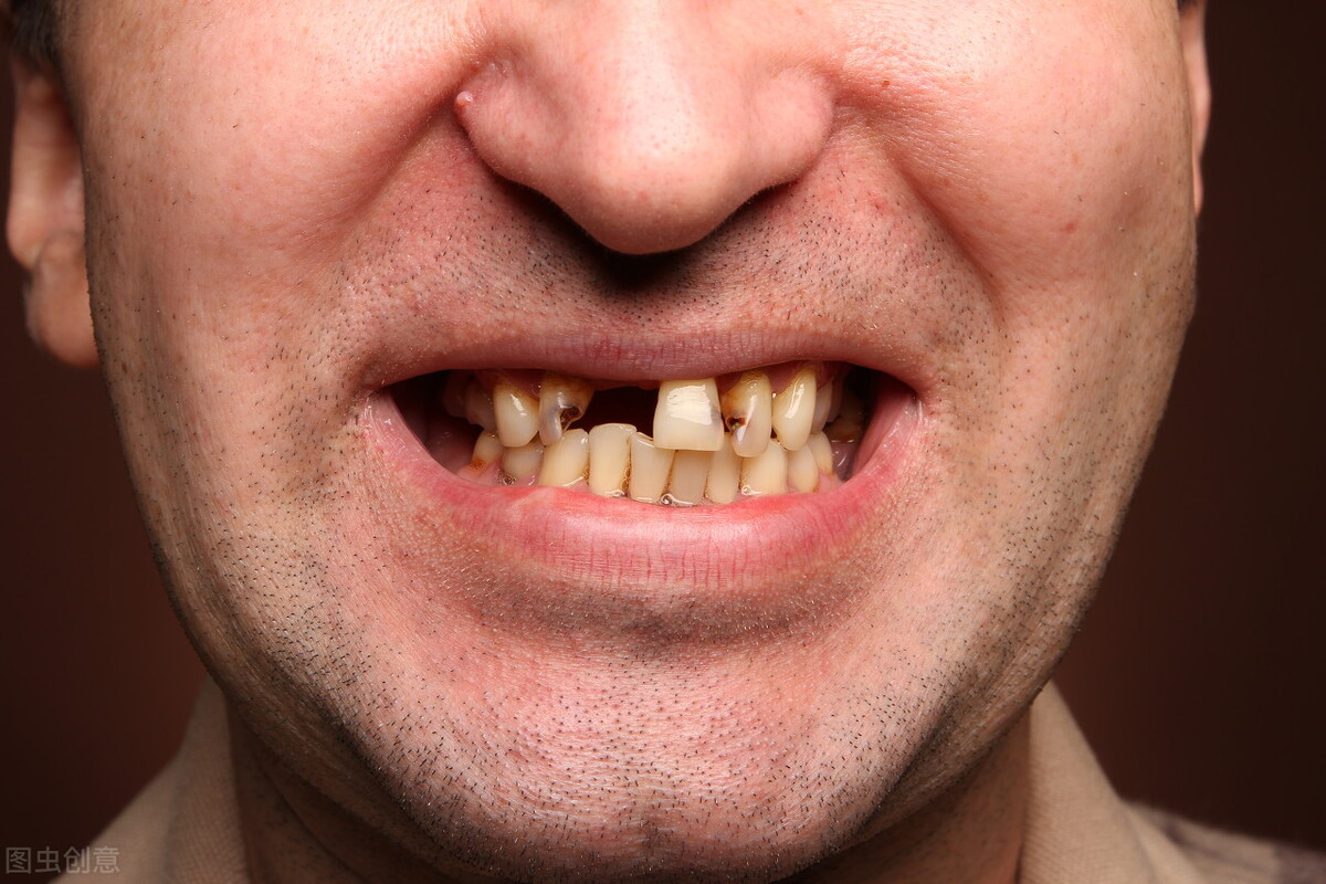 槟榔的危害性很大,为什么还有6000万人嚼它,是什么原因?