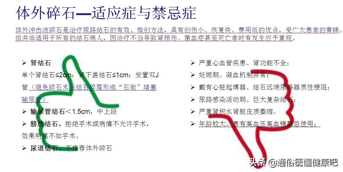 体外冲击波“碎石”和输尿管软镜“取石”，谁更“胜”一筹？