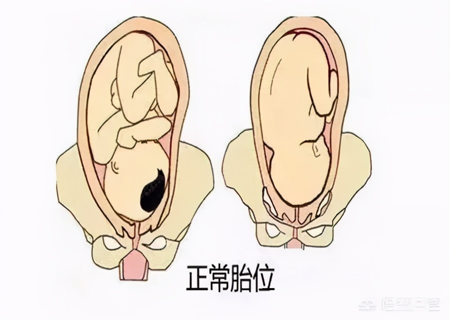 新生儿屁股为啥会“淤青”？传说很动人，但真实原因宝妈要知道