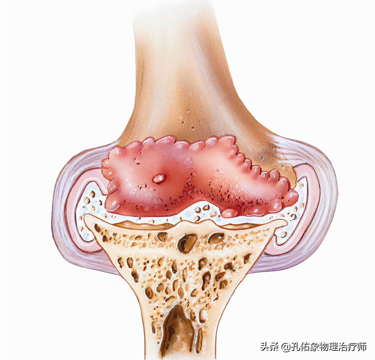 膝关节为什么疼痛？能治好吗？该如何应对呢？给您详细讲清楚