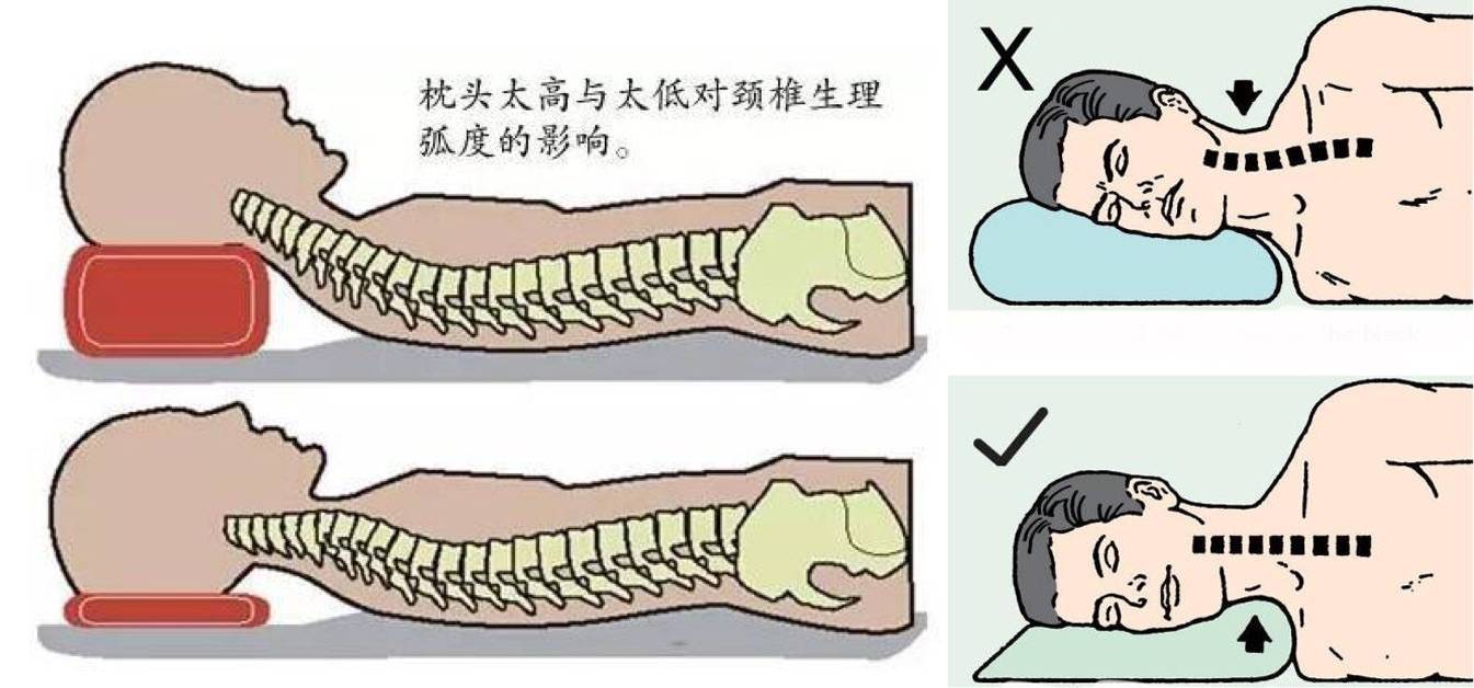 颈椎按摩仪怎么选？多年颈椎病患者对比四款颈椎按摩仪