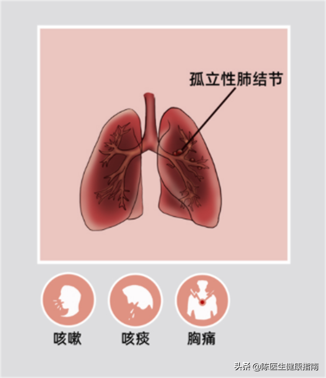 肺结节是什么？癌变的概率有多大？需要治疗吗？