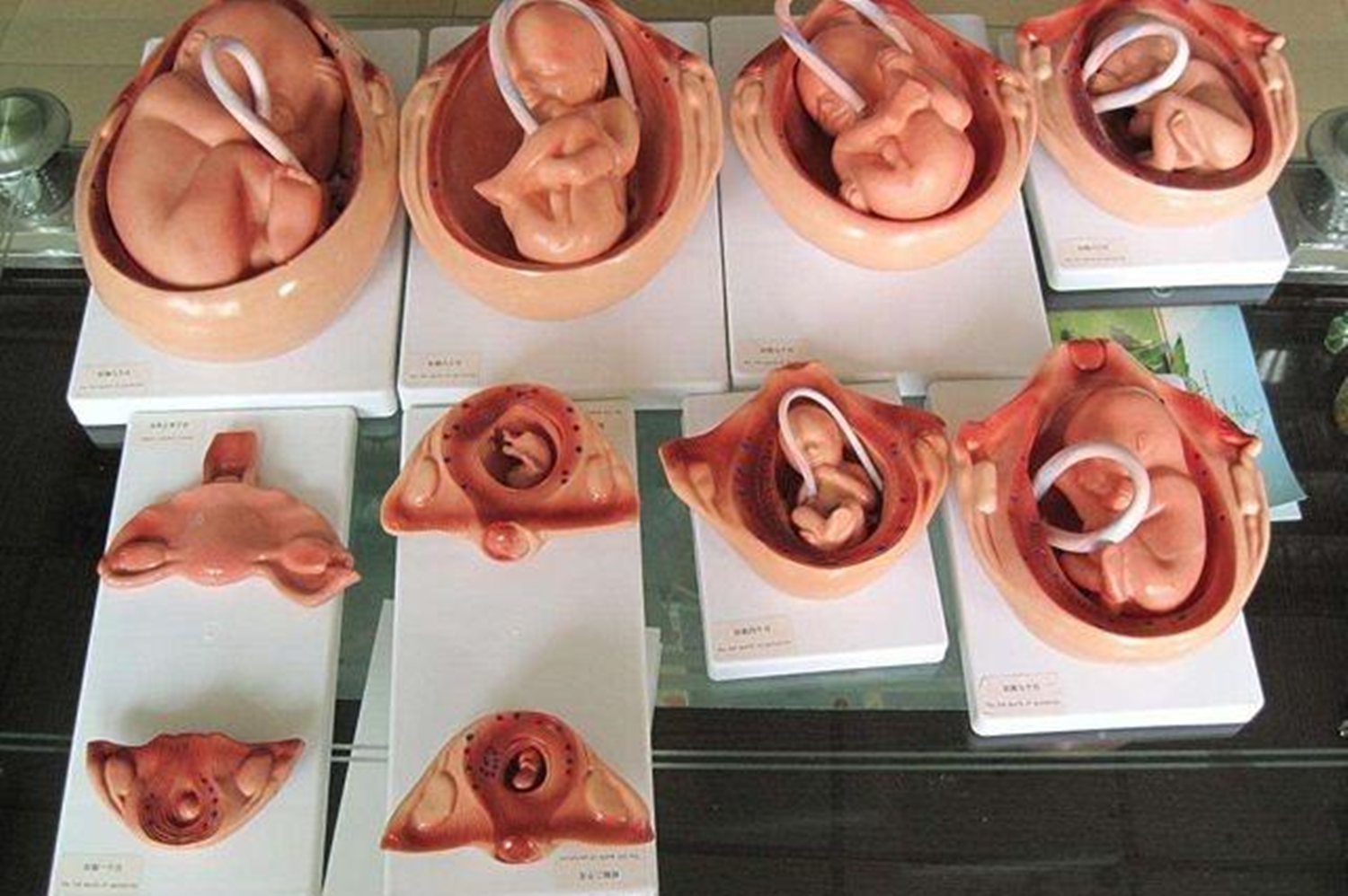 胎儿有了心跳之后,请别选择"打掉"他,因为引产过程实在残忍