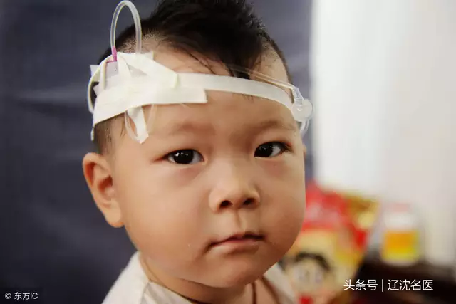 高烧持续不退的可能原因及处理方法