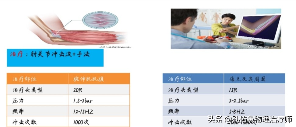 打羽毛球打到肘部痛什么原因(网球肘是累出来的，跟打网球没啥关系，如何预防及治疗？真相来了)