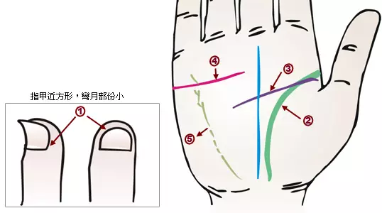 掌纹诊病：可以诊断肝癌、糖尿病、高血压、妇科病、脑溢血