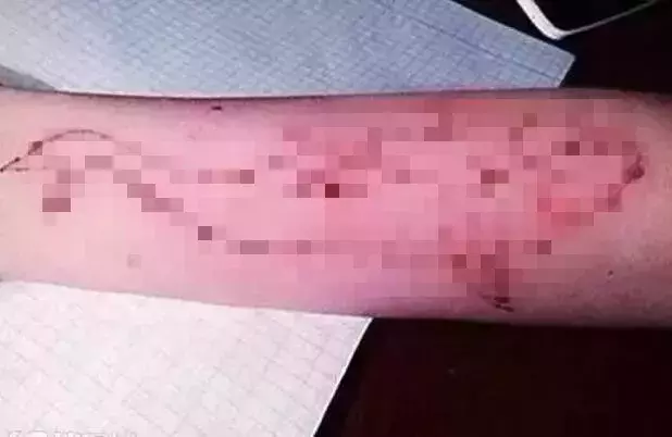扑朔迷离！重点高中学生手脚被缚、头套塑料袋死于家中，死前曾在网上搜…