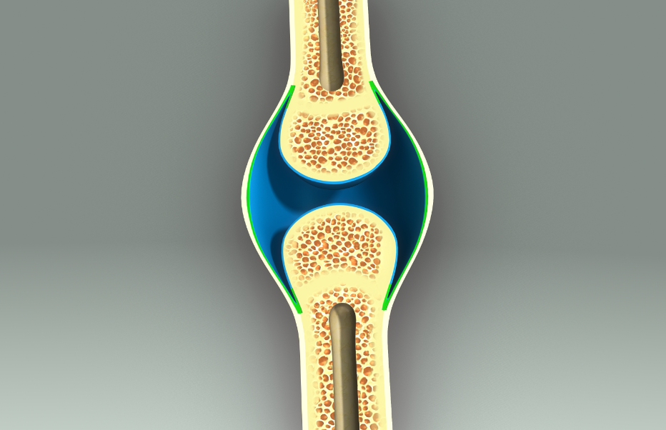 儿童期过量运动，小心孩子长不高