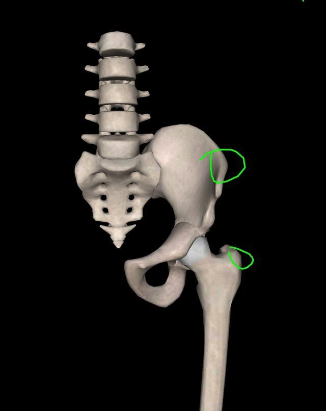 总结一下:本来真胯骨应该是最宽的地方,现在大转子转到前面来了,变成