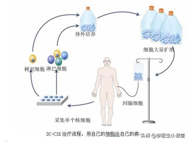 什么是免疫治疗？免疫治疗靠什么延长癌症患者生命？