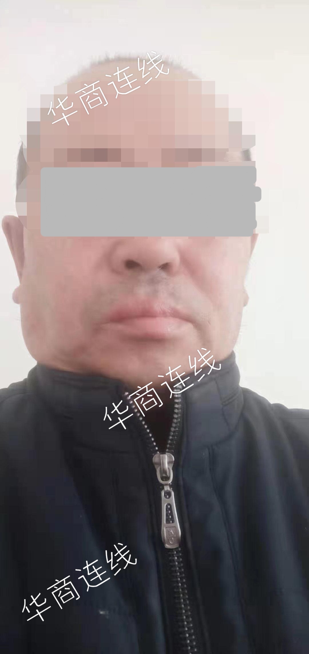 男子致人重伤，取保潜逃20年间多次返家，办了二代身份证和低保，一审获刑3年，被害人称量刑偏轻将上诉