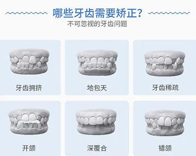 又到“牙齿矫正季”，对于颜值有哪些影响