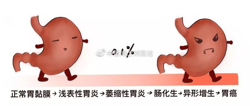 萎缩性胃炎能逆转吗？要怎么治疗？