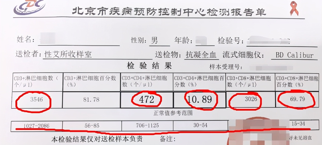 艾滋病会经历3个阶段，这些身体症状，思想开放的人要留意