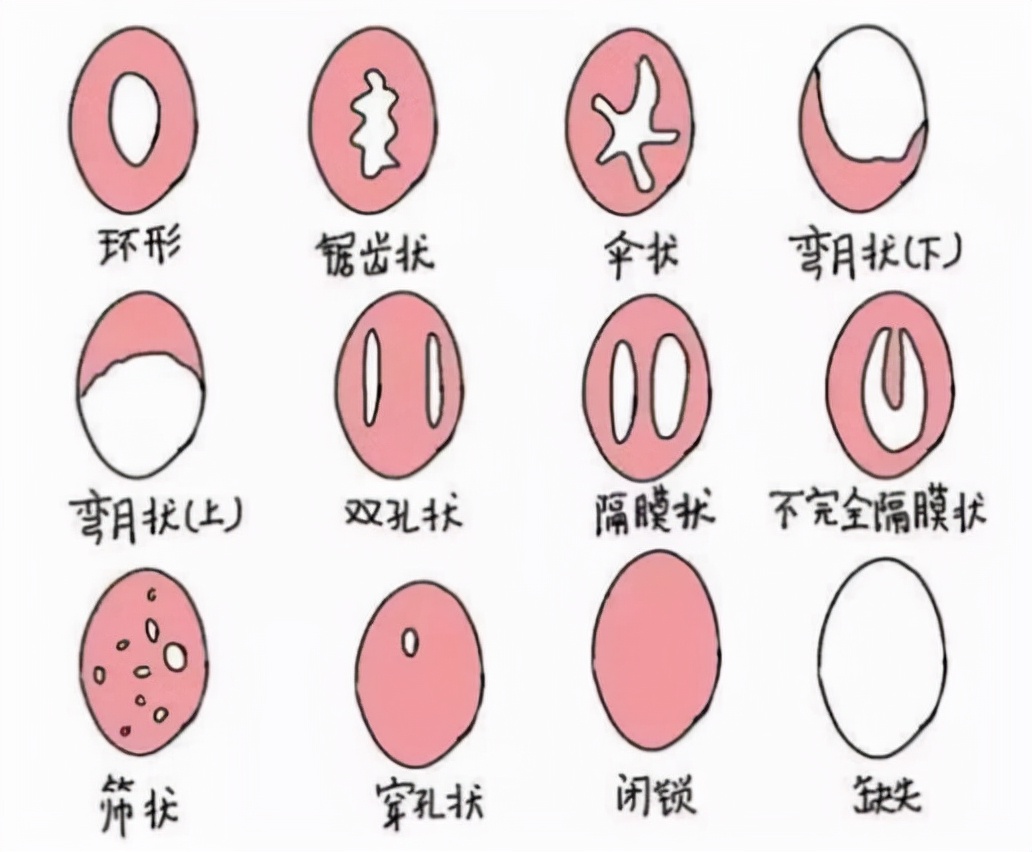 处女能检查出来吗？这层膜到底有什么用？作为女生一定爱护好自己