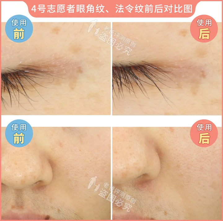 网红家用美容仪真的有效吗？2个多月的跟踪实测结果来了