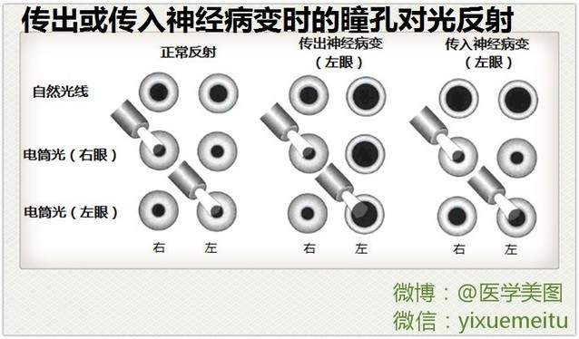 神经元结构示意图（神经元结构示意图手绘）-第41张图片-科灵网