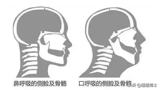 同样是凸嘴，为什么这些女明星就这么漂亮？两招教你摆脱土气脸