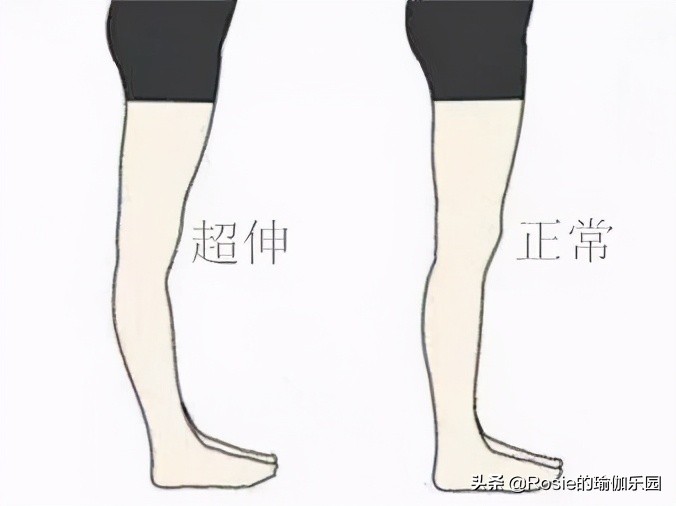 不跑不跳腿粗腿壮？分清类型做好这2步，轻松拥有刘诗诗同款美腿