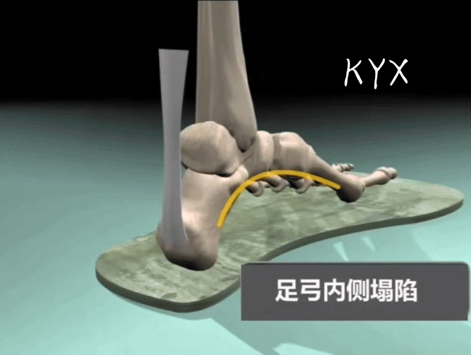 膝关节疼痛是怎么回事？常见的6个部位、8大病因，不可忽视