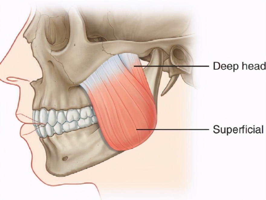 怎么让咬肌变小