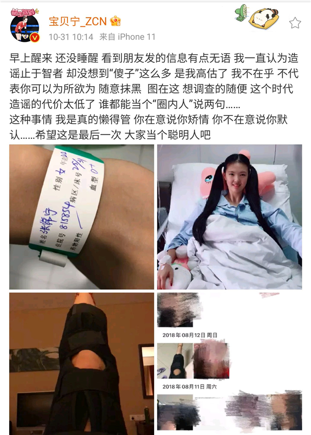 张常宁直盯着朱婷(张常宁住院照太漂亮！涂红指甲，扎俩马尾辫，笑起来像清纯女学生)