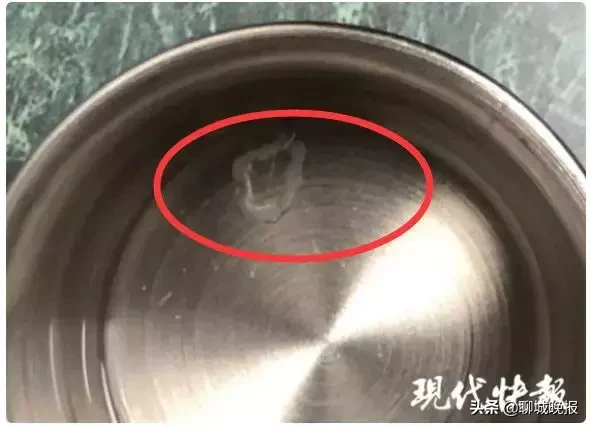 3岁男孩身上包块会“动”,从肚子右侧“跑”到左侧,医生划开一看…