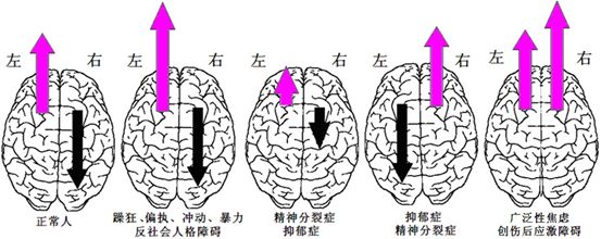 给大脑来场“磁疗”就能治抑郁？华西医院郑重教授这样说