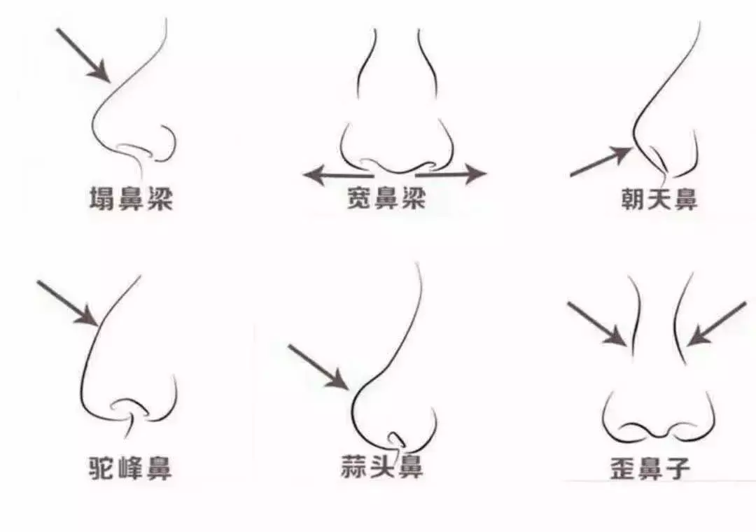 最漂亮的3种鼻子,第1种很少有人有