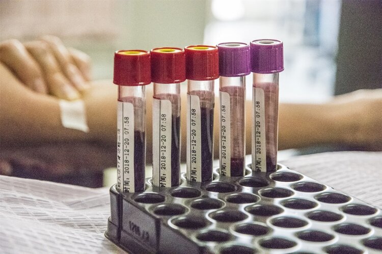 又被影视剧骗了！直系亲属不能输血，血型一样也不行，很危险