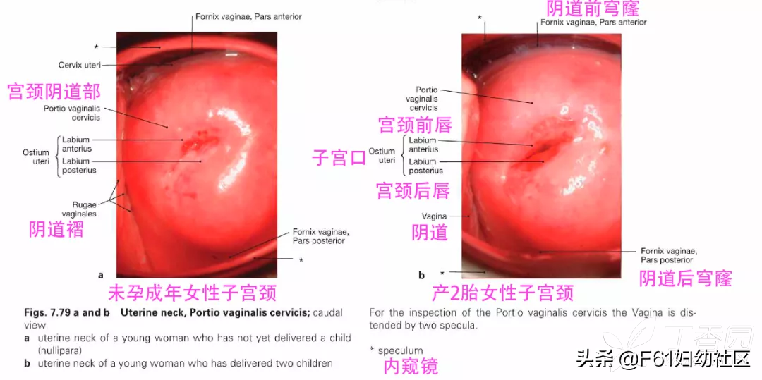 子宫颈是什么样的(女性生殖解剖（子宫部分）)