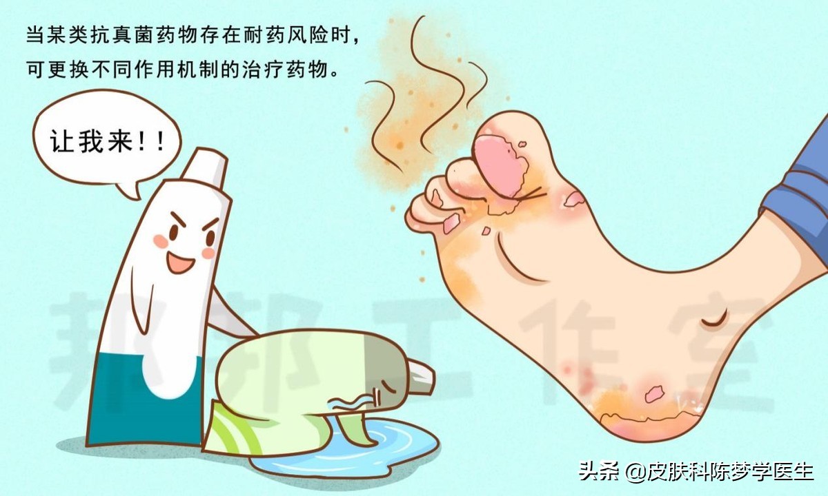 十几年的老脚气，反反复复老不好该怎么办？
